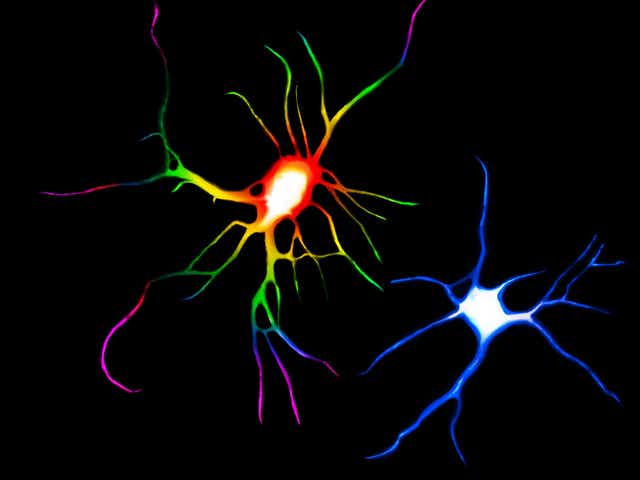 Psychedelic drugs such as LSD and ayahuasca could treat depression by causing nerve cells to sprout more branches and spines. In this image, the rainbow-coloured cell was treated with LSD compared to a control cell in blue