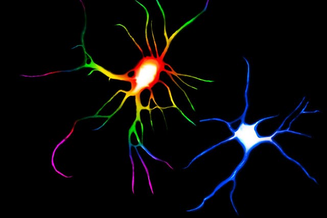 Psychedelic drugs such as LSD and ayahuasca could treat depression by causing nerve cells to sprout more branches and spines. In this image, the rainbow-coloured cell was treated with LSD compared to a control cell in blue