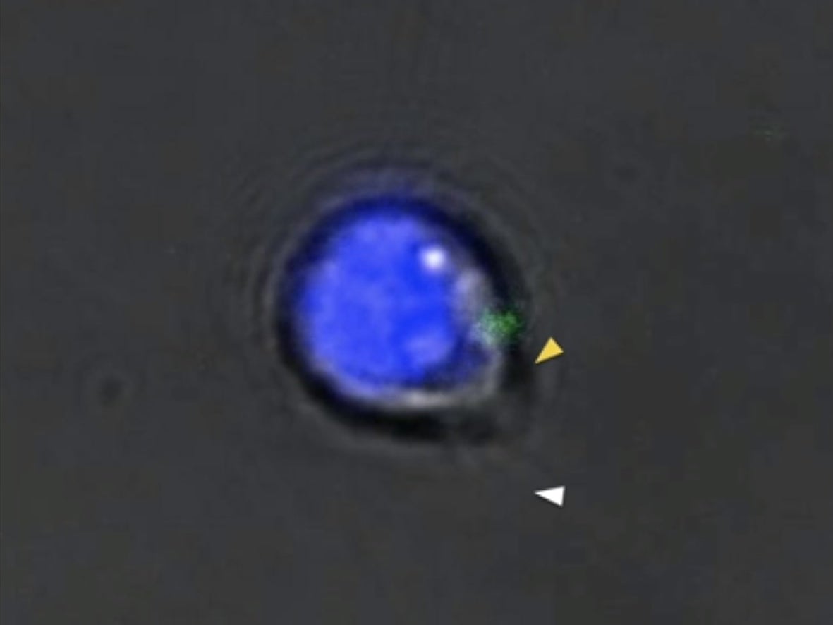 Live imaging of a planarian flatworm adult pluripotent stem cell