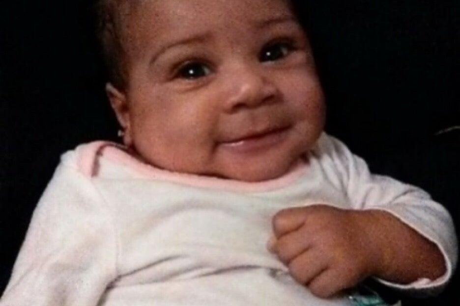 Paige was sleeping when the dog attacked her