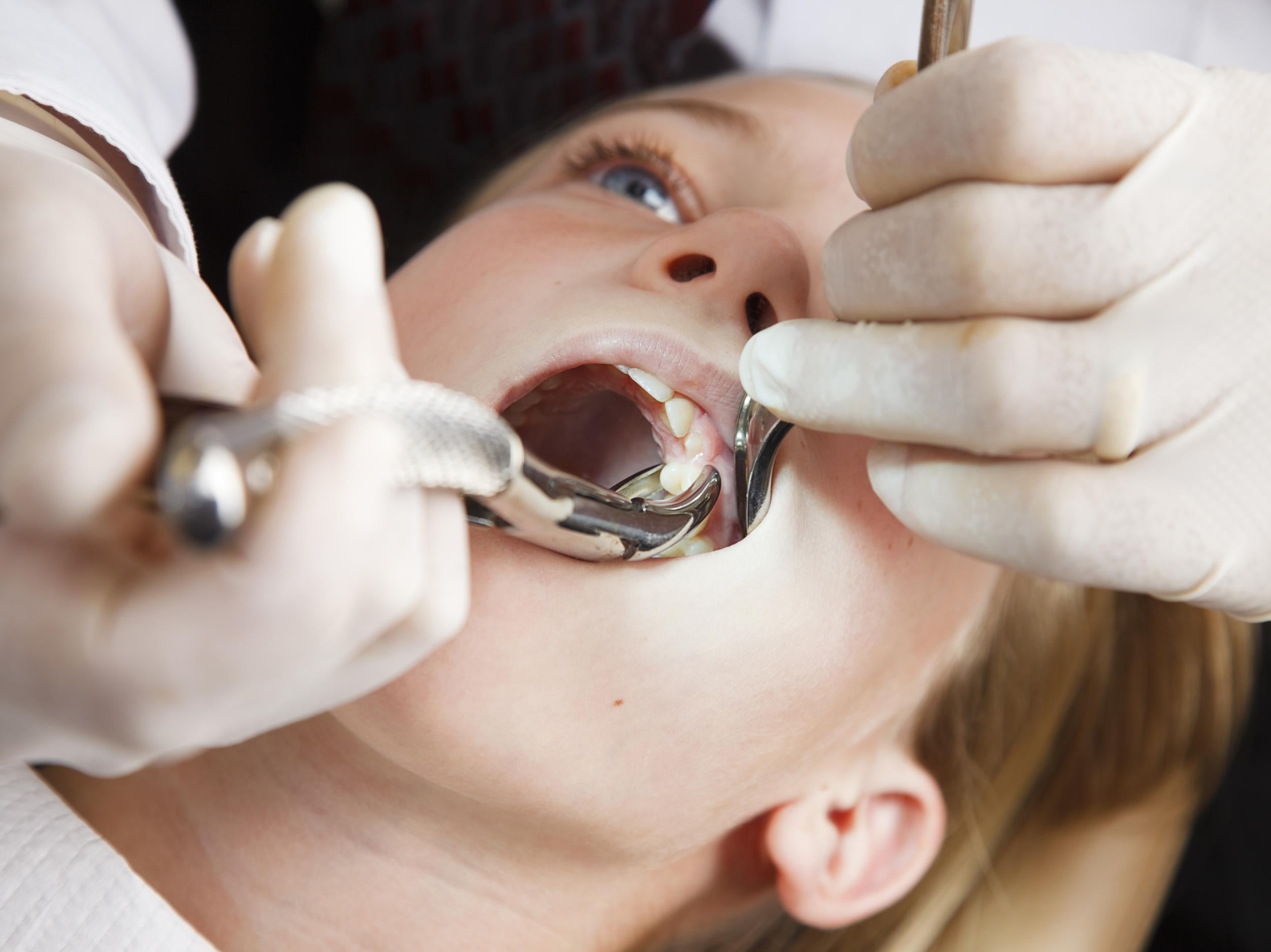 Poor dental hygiene in mothers can be passed down to their children, a new study has found