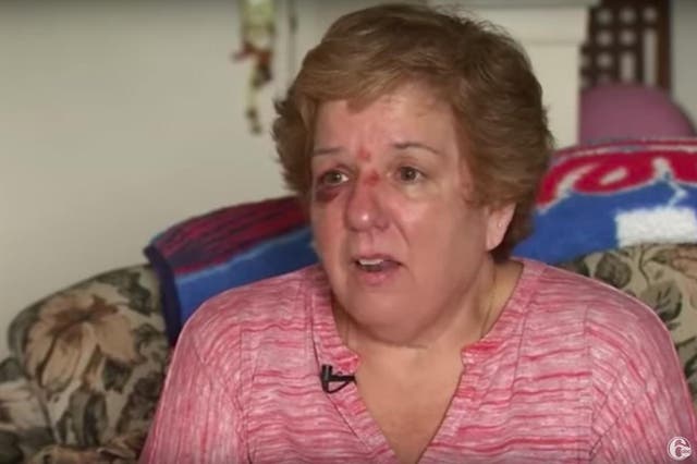 Kathy McVay (pictured) suffered a bruise after being struck by a flying hot dog at the Philadelphia Phillies game on Monday night (WSPA 7 News/Youtube)