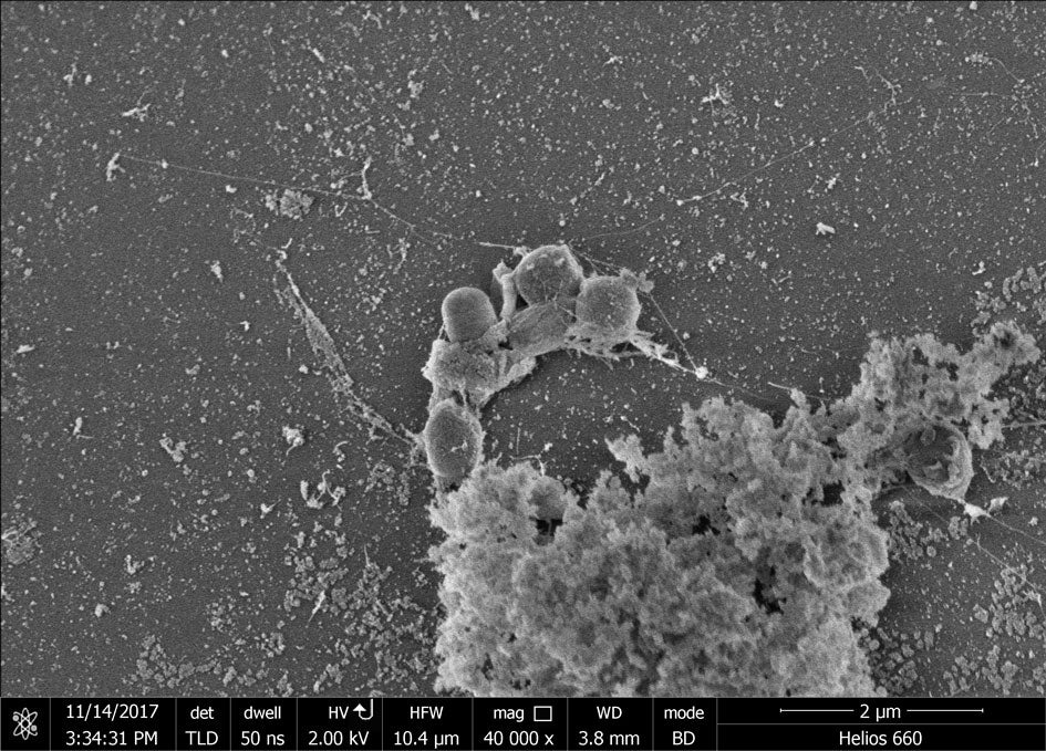Image reveals colonies of bacteria growing on a strip of PET plastic (Claudia Lopez/Oregon Health Science University)