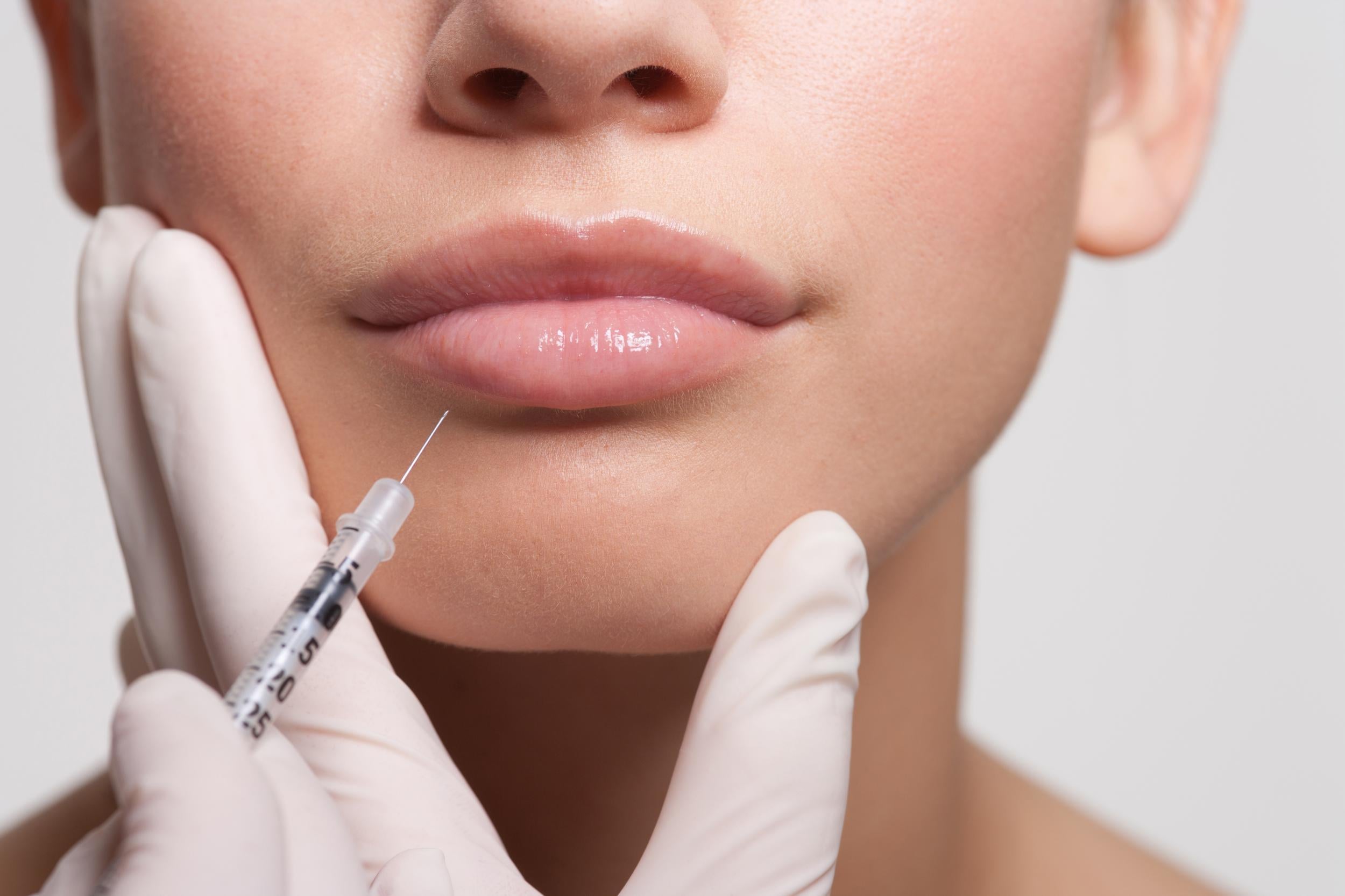 Botox is still one of the most popular procedures (Stock)