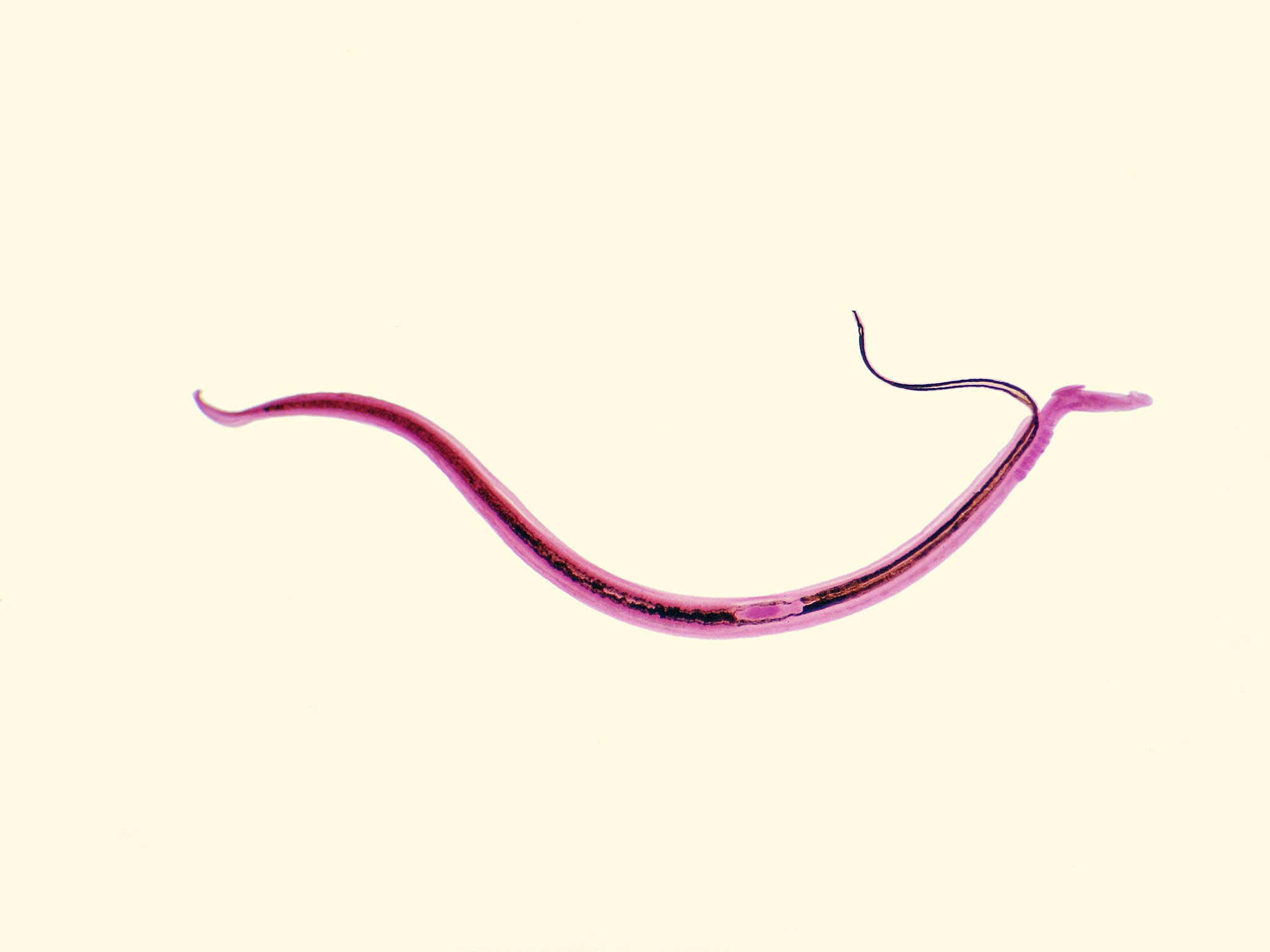This parasitic worm can be deadly – and it's coming to Europe, The  Independent