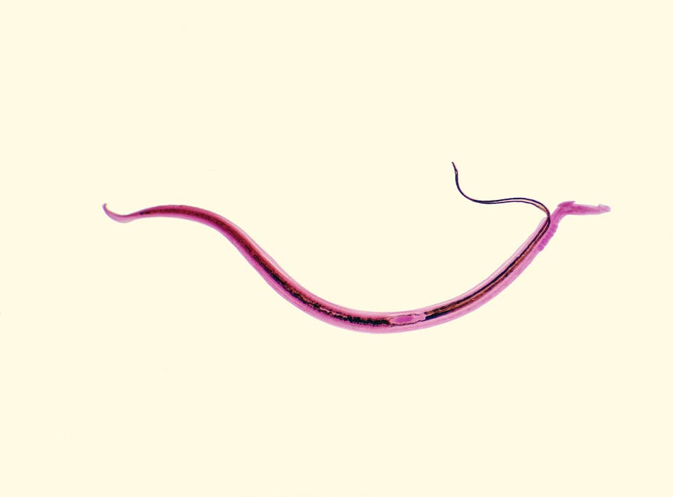 Schistosomiasis uk. Schistosomiasis a worm