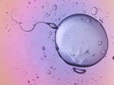 Father’s faulty sperm adds to repeat miscarriage risk, study says