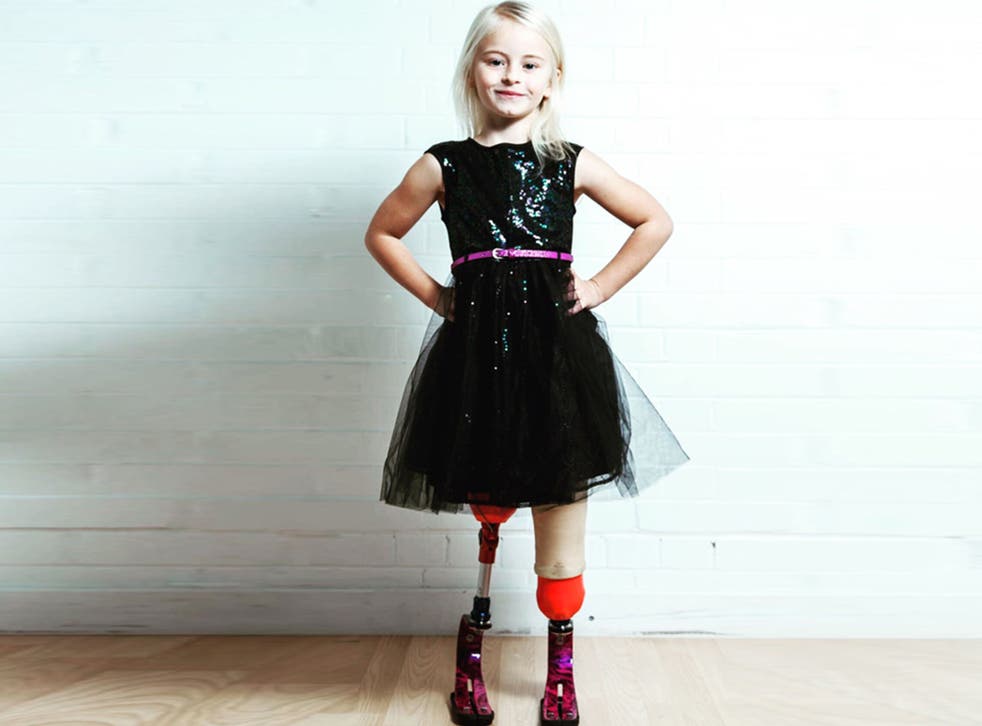 Daisy-May Demetre was born with a condition called fibular hemimelia, a birth defect where part or all of the fibular bone in the leg is missing