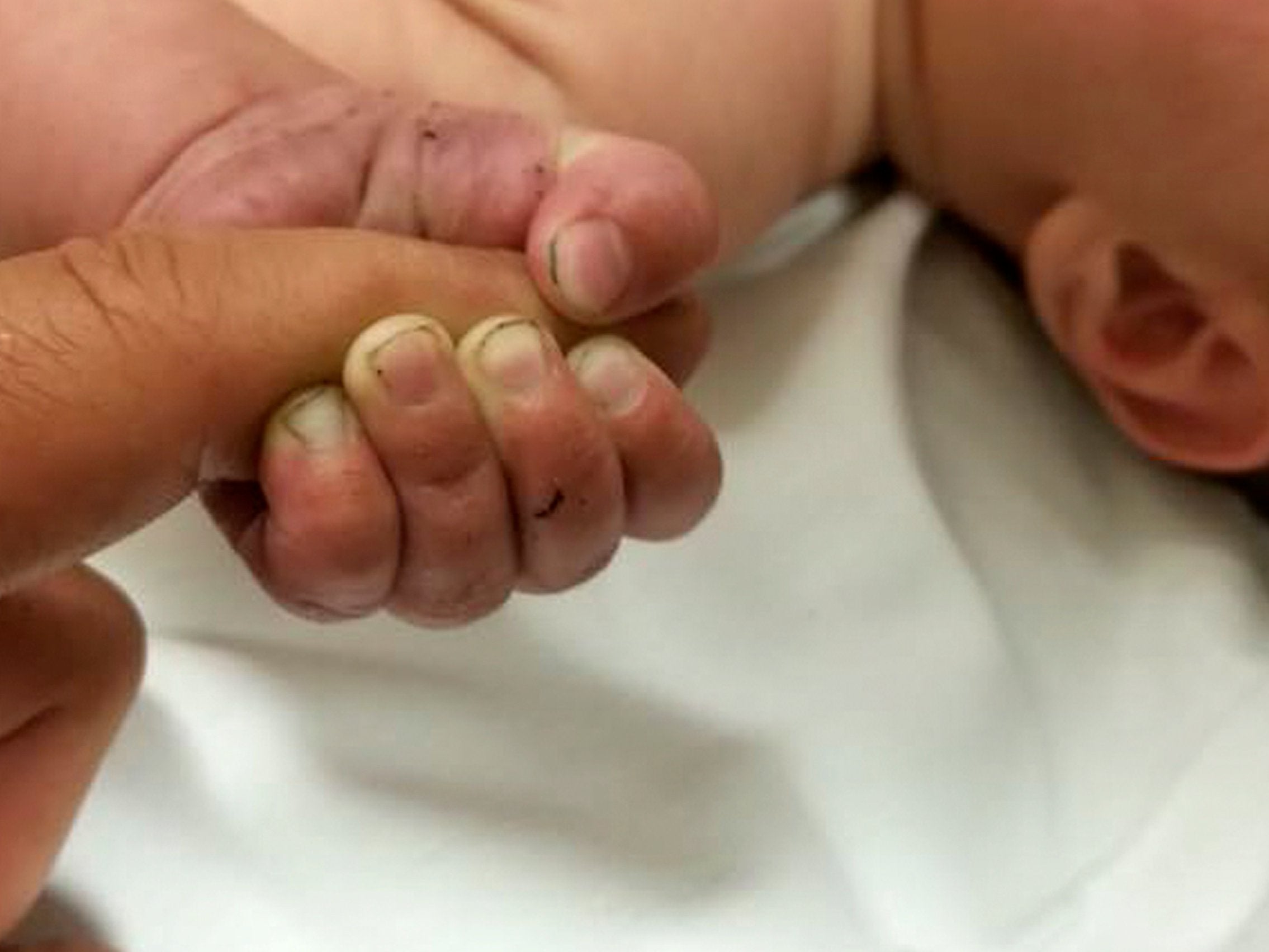 The five-month-old infant with dirt under their fingernails survived about nine hours after being buried under sticks and debris in the woods