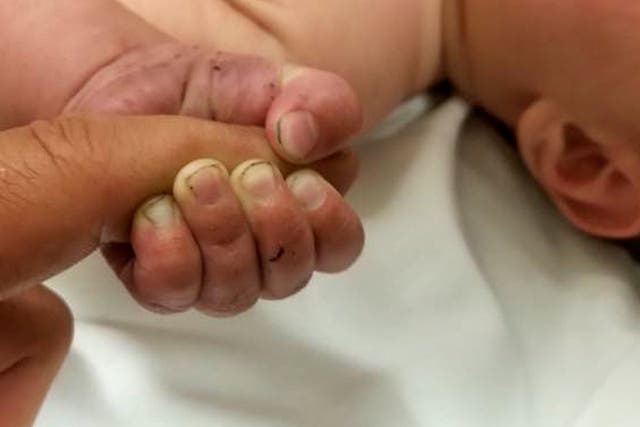 The five-month-old infant with dirt under their fingernails survived about nine hours after being buried under sticks and debris in the woods