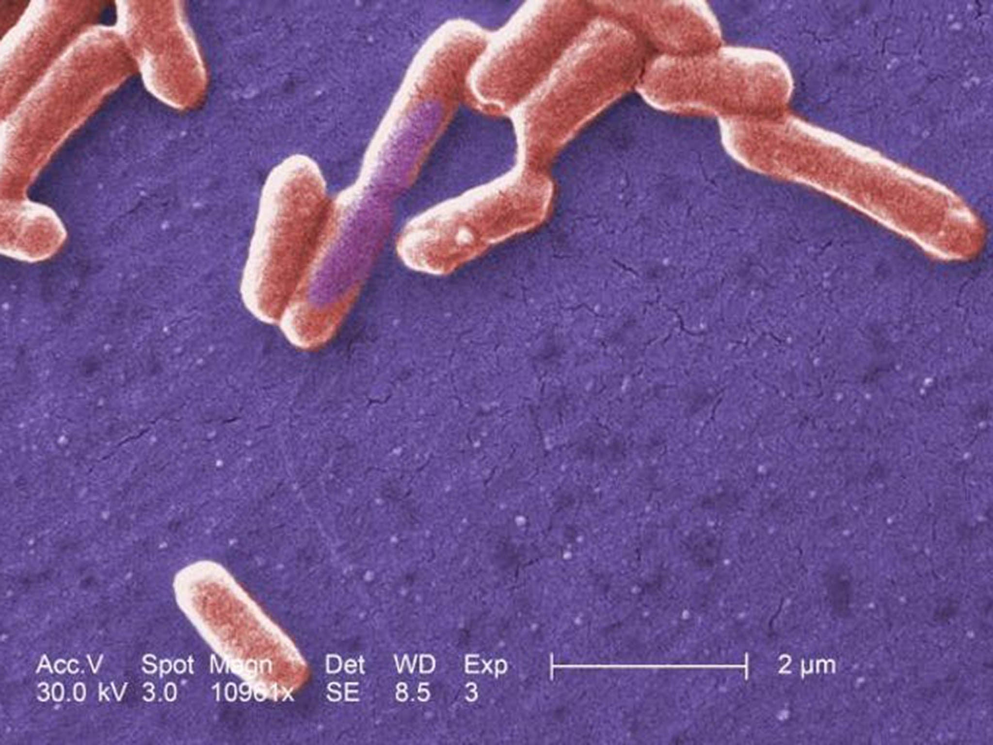 E coli can survive in higher oxygen environments than the normal colon