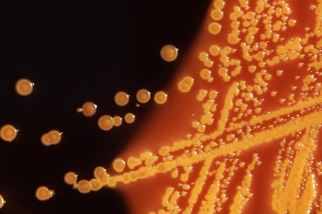 Colonies of E. coli bacteria grown on a Hektoen enteric (HE) agar plate are seen in a microscopic image courtesy of the U.S. Centers for Disease Control (CDC).