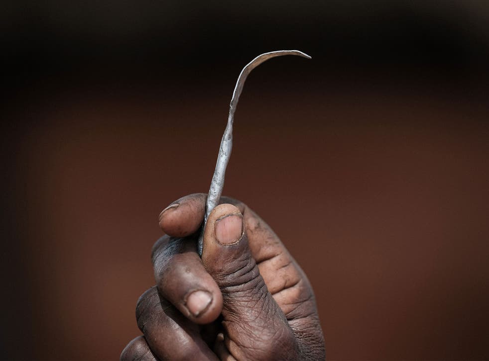 FGM is illegal in the UK, whether performed in the country or abroad 