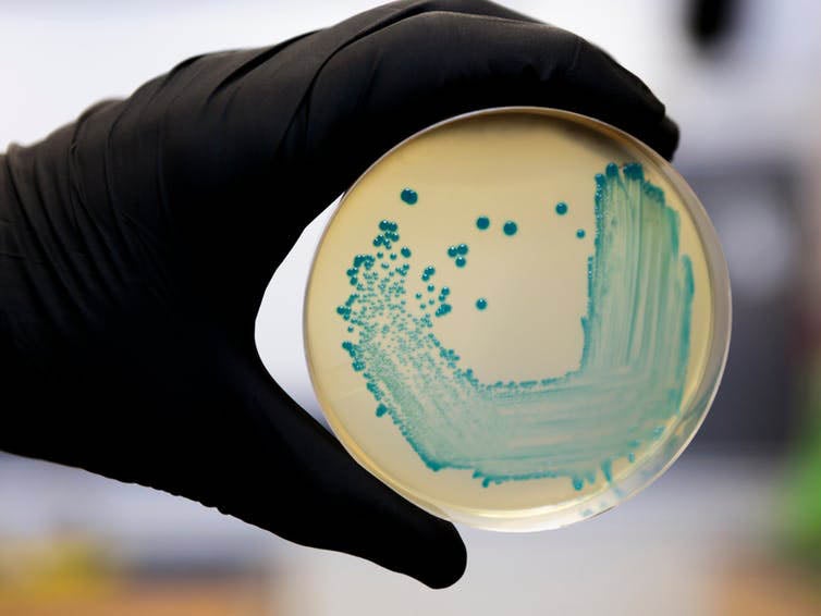 Listeria bacteria can be deadly