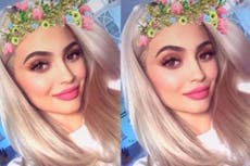 Teenagers are getting plastic surgery to look like their selfies