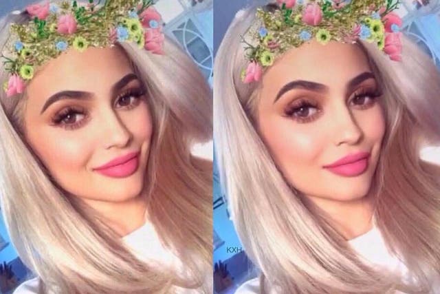 Millennials are getting plastic surgery to look like their selfies (Kylie Jenner Instagram)