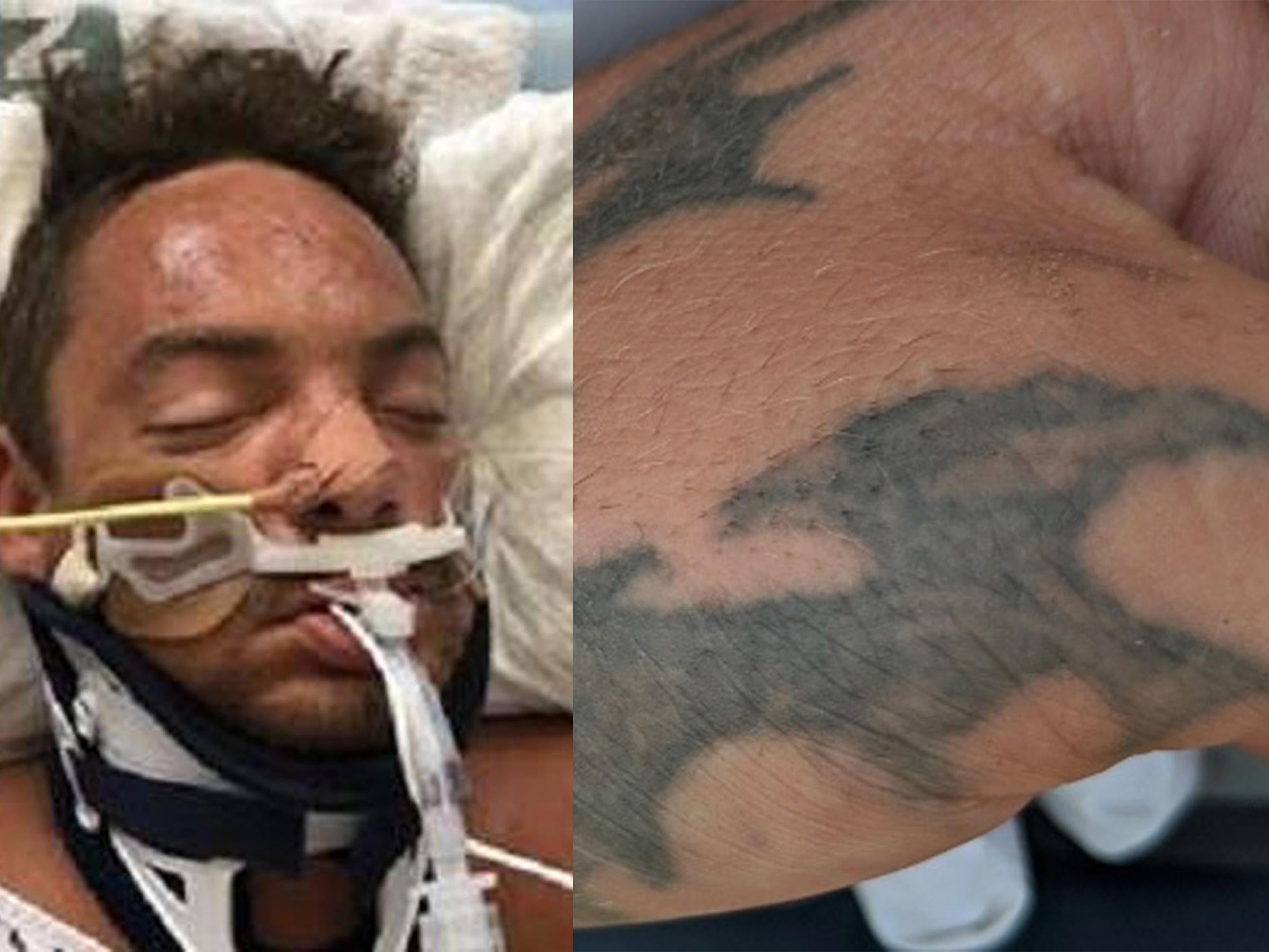 Viewer Discretion Advised* (Postmortem pictures) I'm trying to identify an  Unidentified deceased male, he has these tattoos… (Are these style tattoos  something that would be considered jail/prison, and/or like single  needle/home type