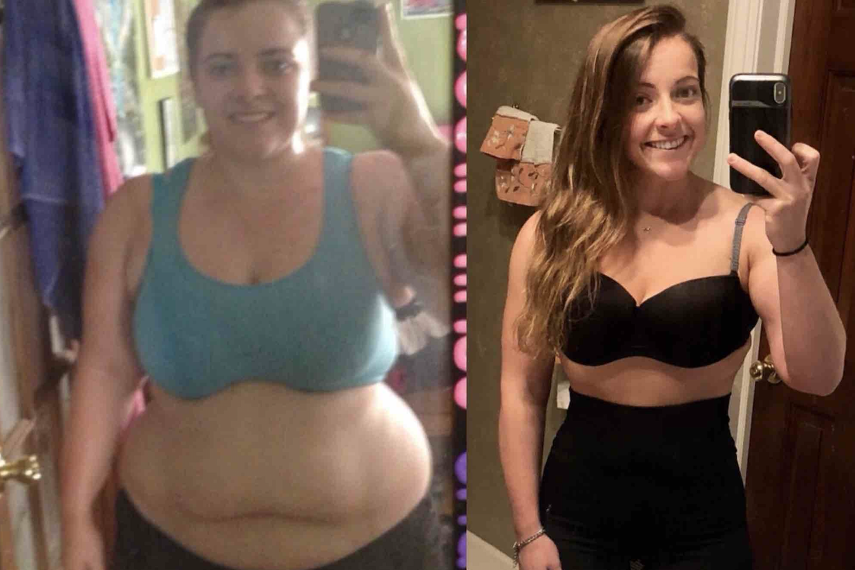 Woman crowdfunds for excess skin surgery after losing half her body weight.