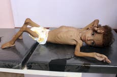 Five million Yemen children face starvation, Save the Children warns