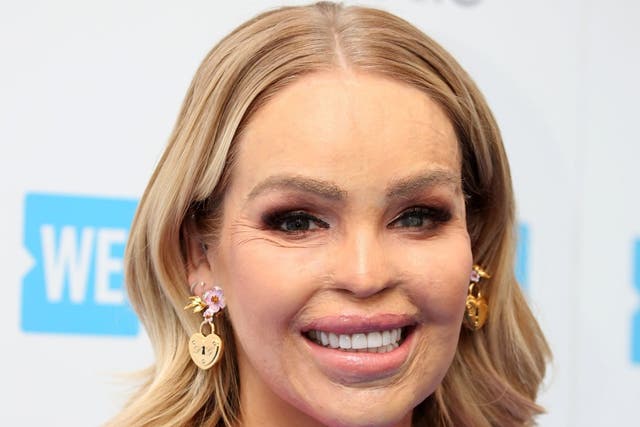 <p>Katie Piper survived an acid attack 10 years ago</p>
