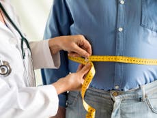 Obesity should be recognised as a disease, medical experts say