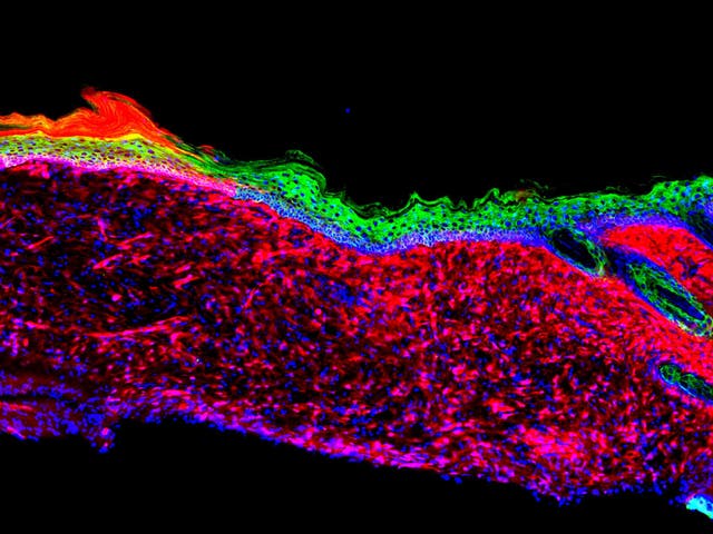 Epithelial (skin) tissues were generated by converting one cell type (red: mesenchymal cells) to another (green: basal keratinocytes) within a large ulcer in a laboratory mouse model
