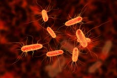 What is E coli and what are the symptoms of infection?