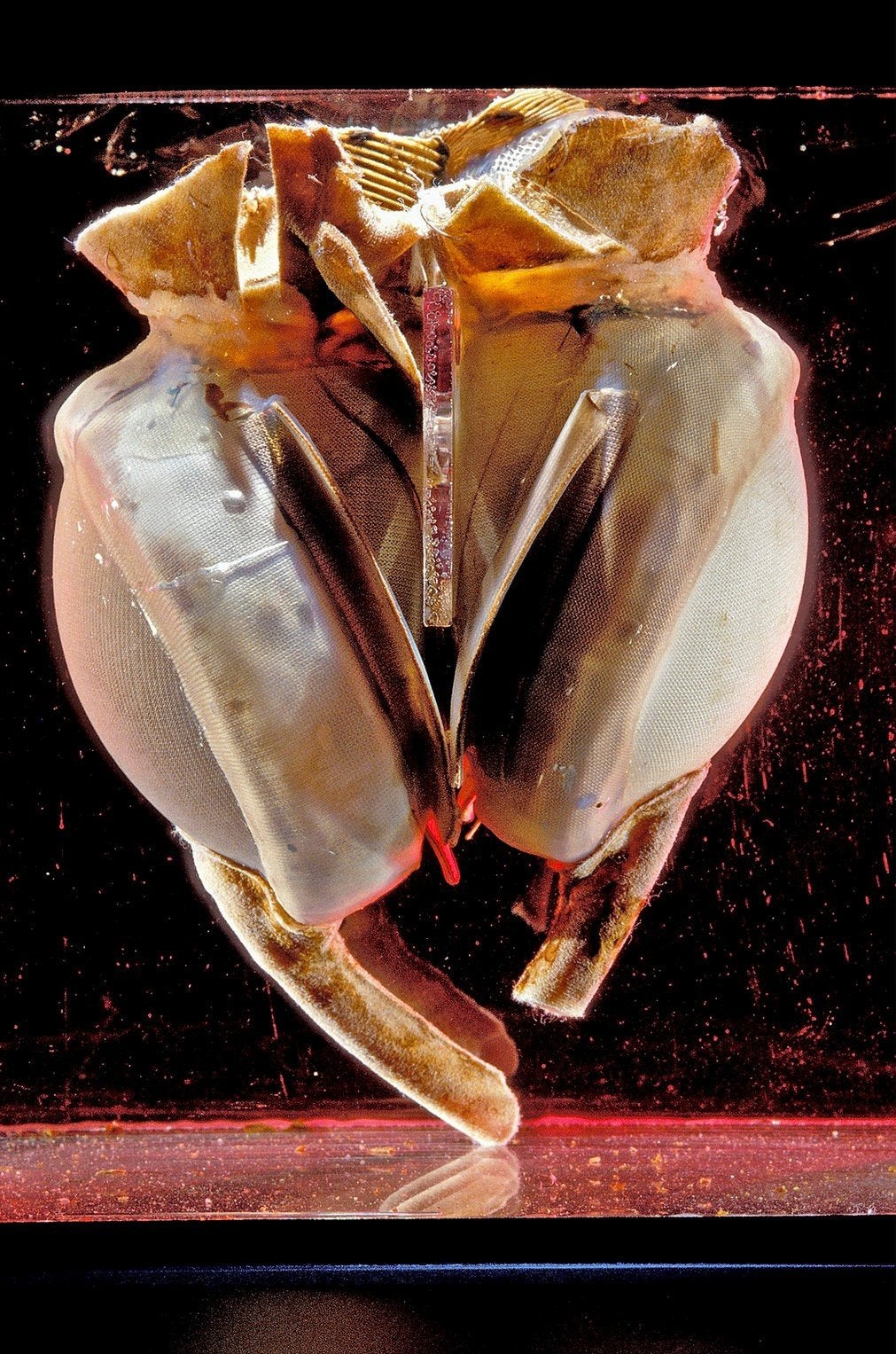 Heartache: plastic in the first totally artificial heart implanted in a human body in 1969 is deteriorating