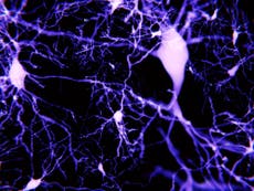 Alzheimer's disease memory loss reversed in mouse study