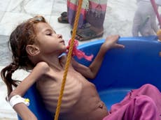 Fight against famine is being lost in Yemen, UN warns 