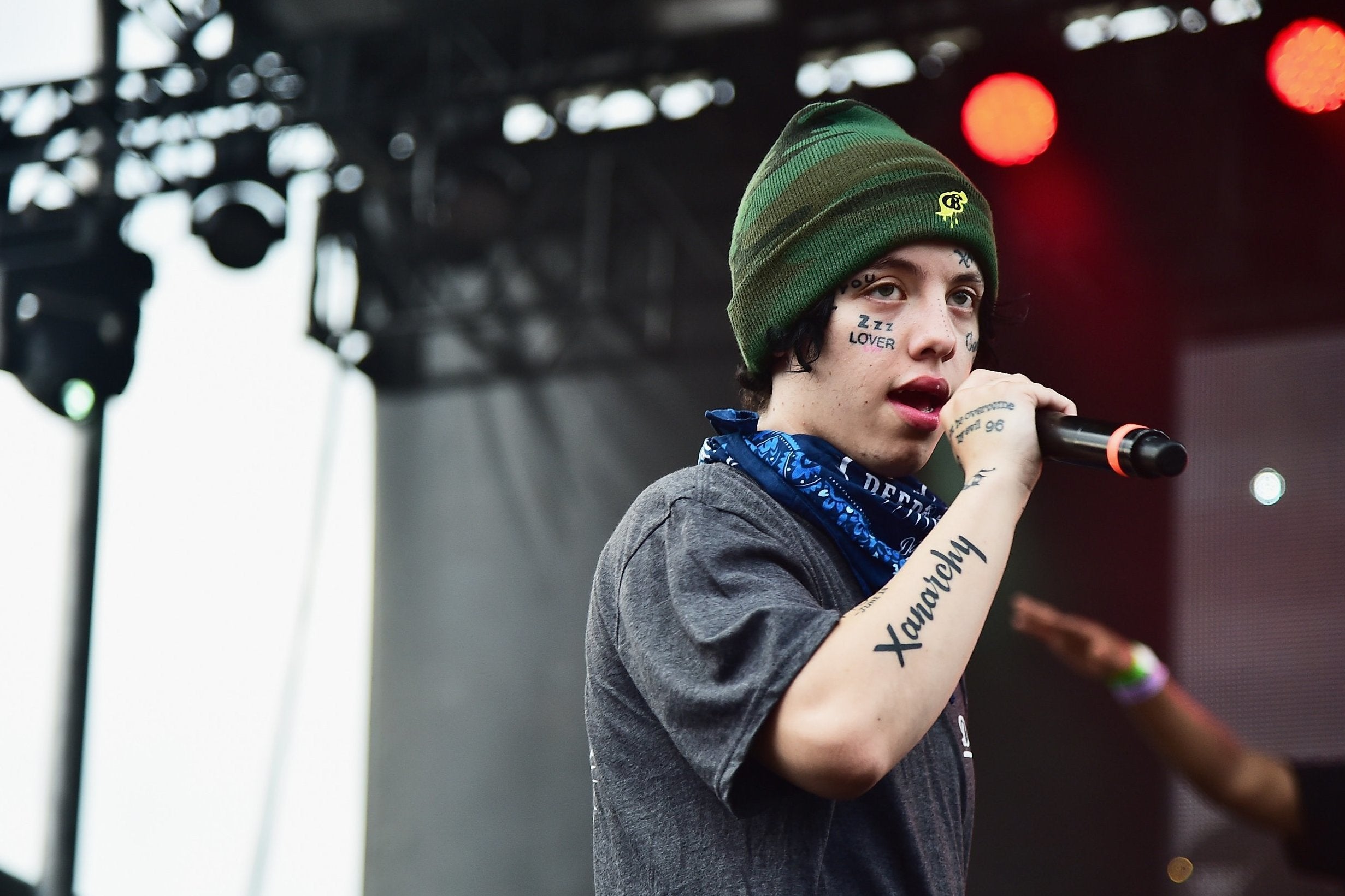 Rapper Lil Xan Says Too Many Flaming Hot Cheetos Put Him In