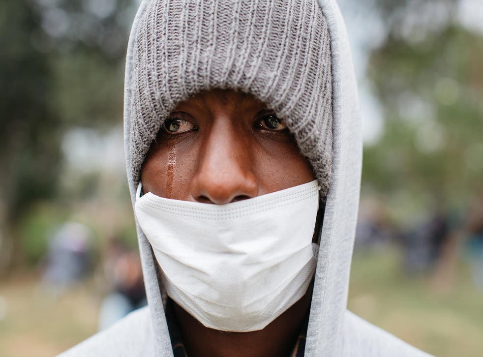 John Hydro Fernandez, 21, has not eaten properly for three years; he is one of millions that has fled political problems, poor living conditions and food shortages