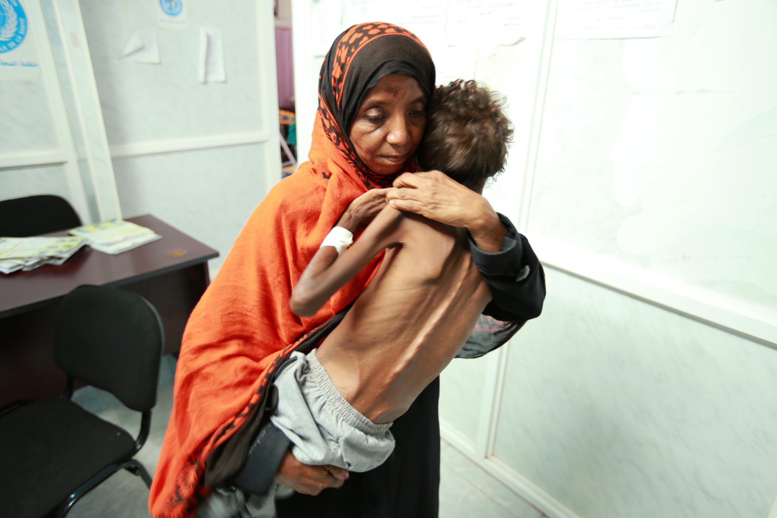 A woman carries her eight-year-old son, who is suffering from malnutrition in Yemen
