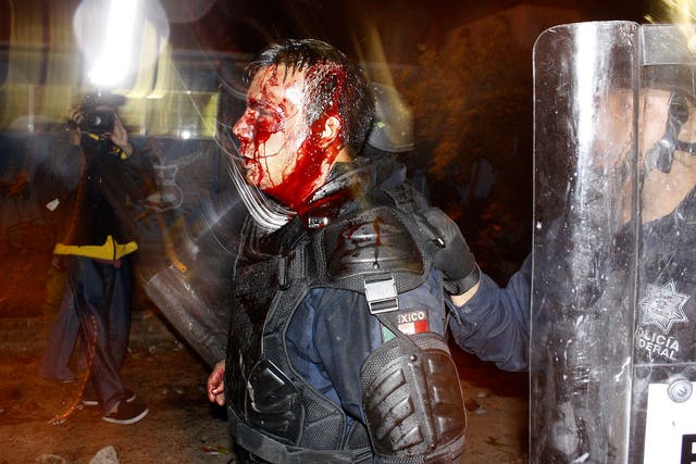 This photo shows a Mexican police officer who was injured in 2012 during a riot involving students at a school – but was used to spread fear about the so-called migrant caravan heading towards the US