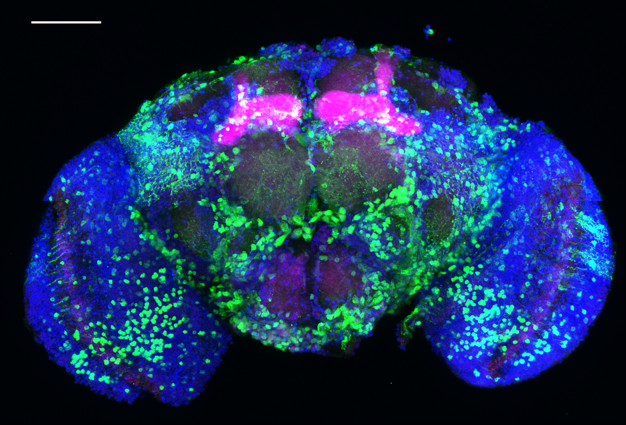 Alcohol ‘hijacks’ a key memory pathway in fruit flies. The pink areas are the fly’s memory centres and the green dots are where the first molecular signalling ‘domino’ Notch has been activated