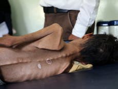 The death of the face of Yemen’s humanitarian crisis is a wake-up call