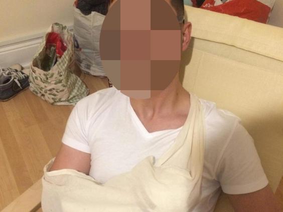 Rahel’s arm was put in plaster after an X-ray confirmed his hand was broken