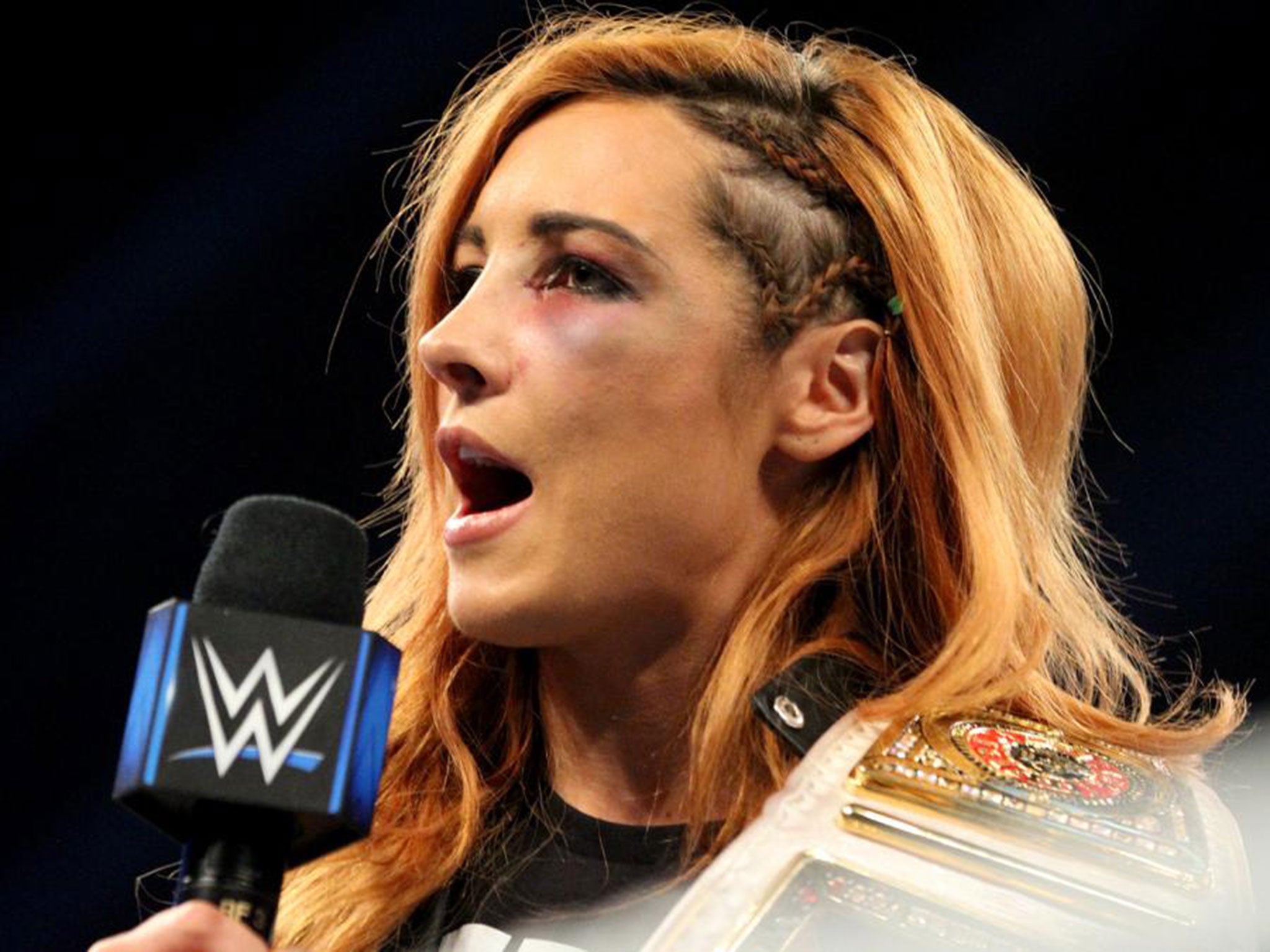 Becky Lynch has been ruled out of her match against Ronda Rousey due to injury