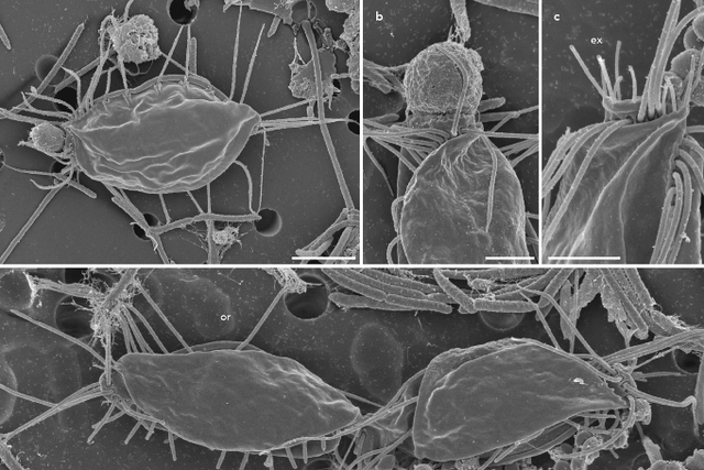 Electron microscopy images of a new species of hemimastigote