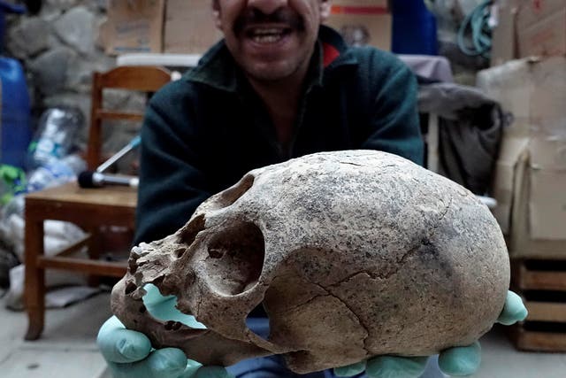 Archeologist Jedu Sagarnaga holds a skull as part of an archeological finding, dated approximately 500 years ago, in Mazo Cruz, near Viacha, Bolivia, November 12, 2018