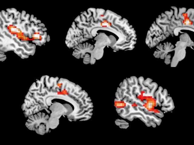 Regions of the brain which showed increased activity on MDMA