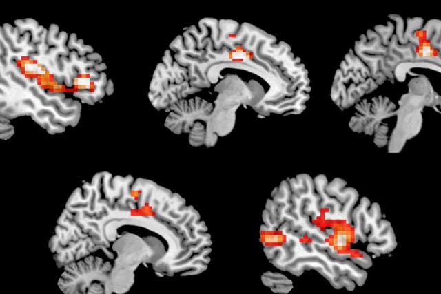 Regions of the brain which showed increased activity on MDMA
