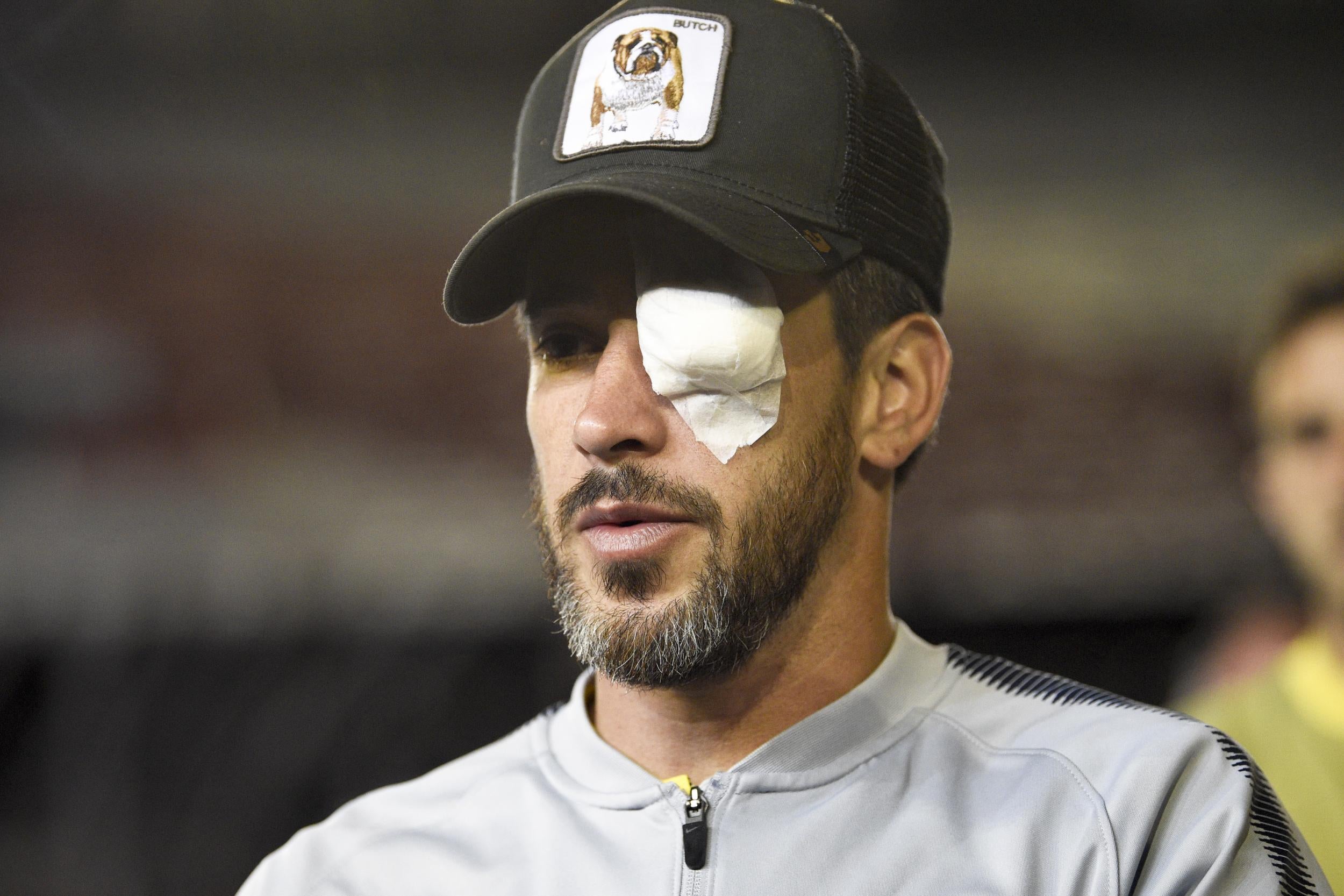 Pablo Perez, the Boca captain, wearing an eye patch following the attack (AP)