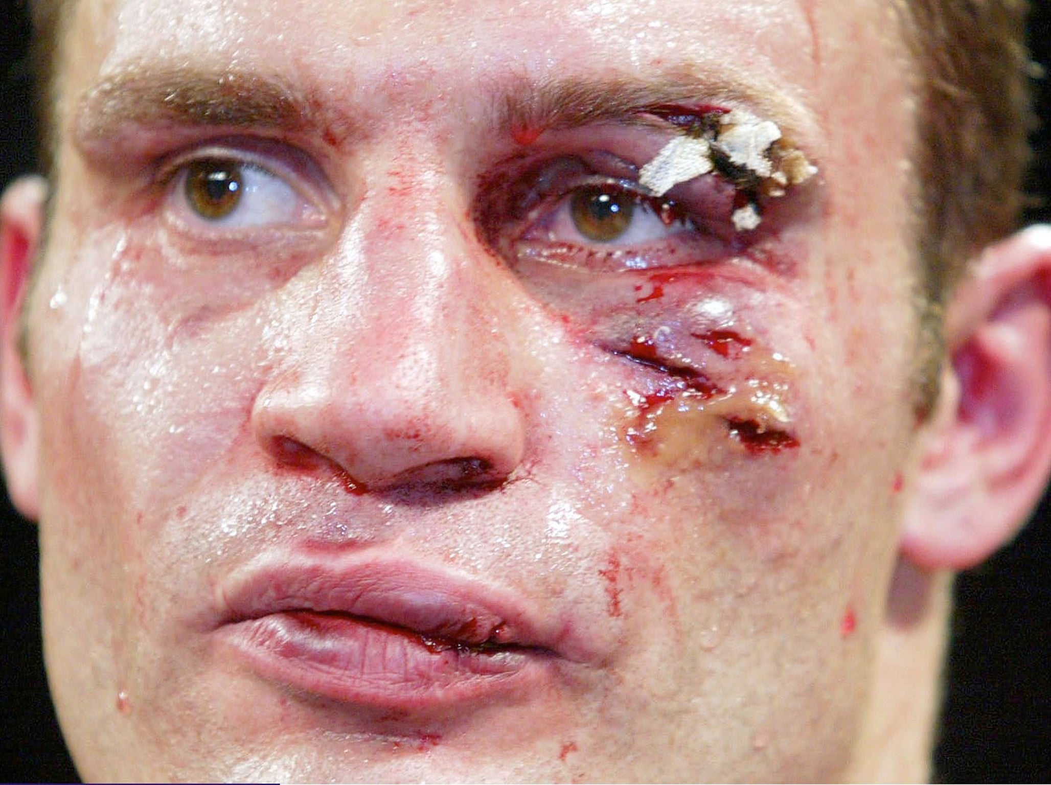 A battered and bruised Vitali Klitschko