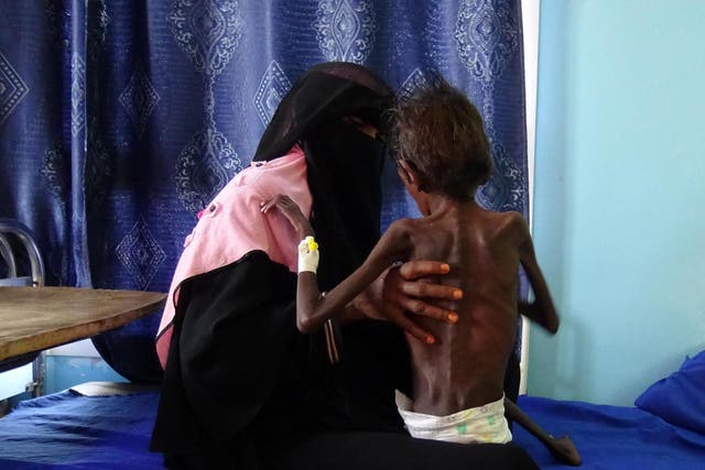 Yemeni mother Nadia Nahari holding her five-year-old son Abdelrahman Manhash, who is suffering from severe malnutrition and weighing 5kg, as she sits on a bed in a hospital in Hodeidah