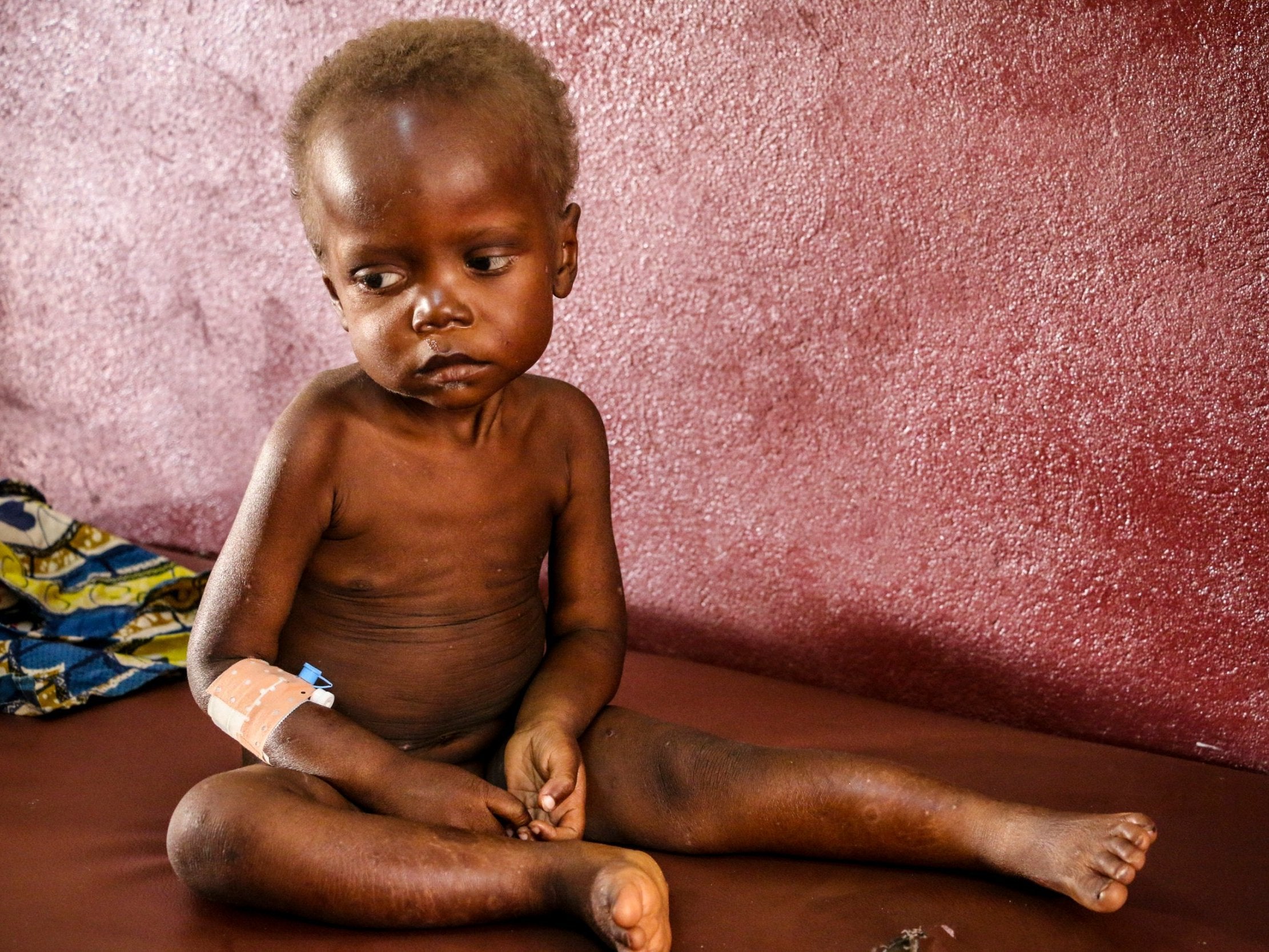 Pierre Mbassissi at the malnutrition stabilisation centre at Complexe Pédiatrique, Bangui’s public paediatric hospital