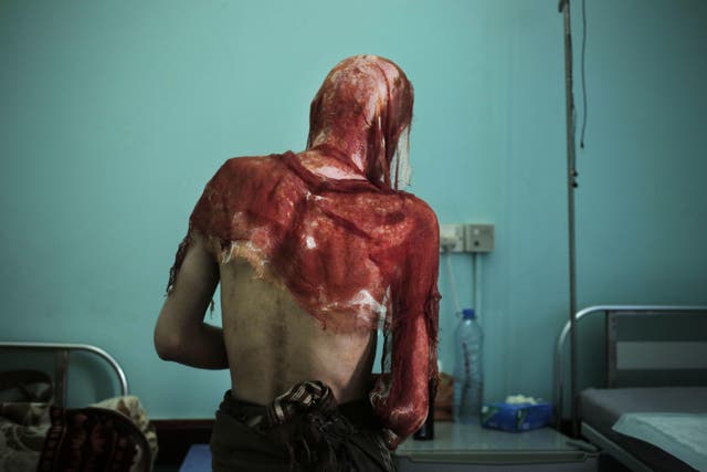 Survivor Monir al-Sharqi was dumped in a stream, half-naked, emaciated and bearing horrific marks of torture after imprisoned by Houthis