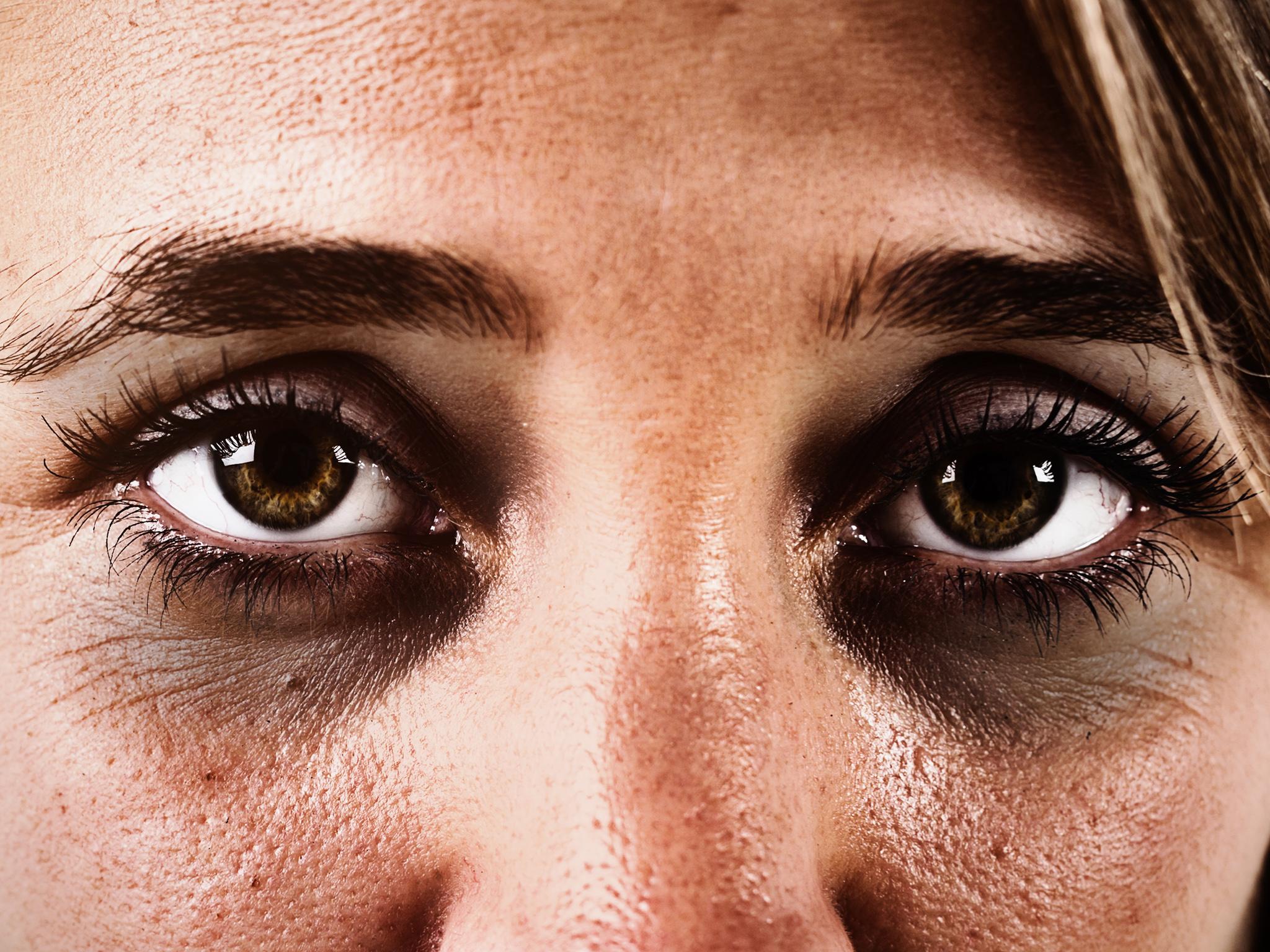 Dark eyes could impede your mental health in winter