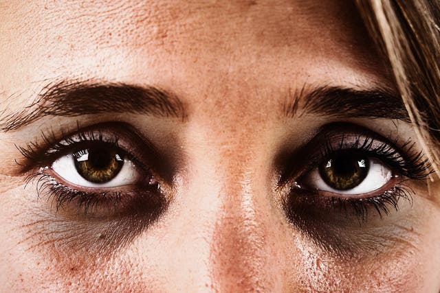 Dark eyes could impede your mental health in winter