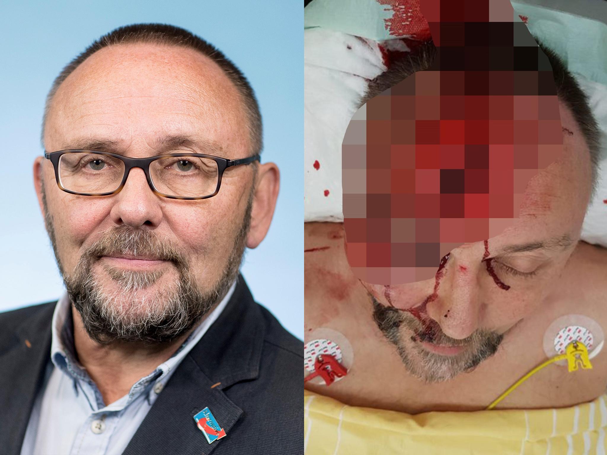 The AfD released a graphic photo of the injuries suffered by Frank Magnitz
